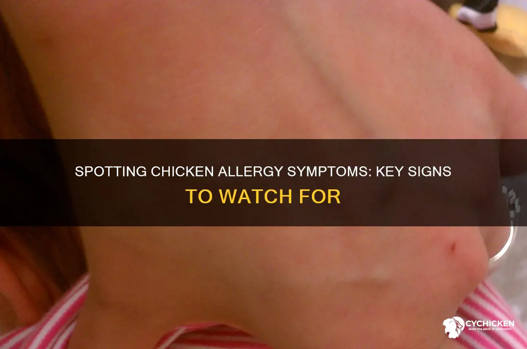 what to notice if youre allergic to chicken