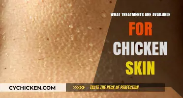 Effective Treatments for Chicken Skin: Smooth Solutions Revealed