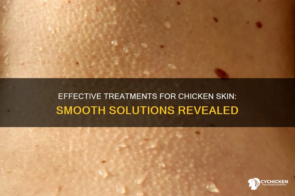 what treatments are available for chicken skin
