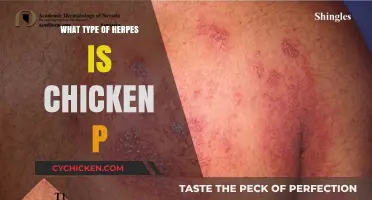 Is Chickenpox a Type of Herpes? Unraveling the Viral Connection