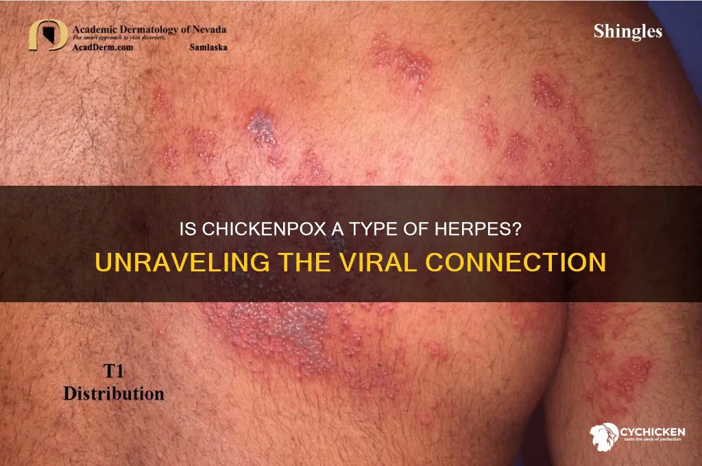 what type of herpes is chicken p