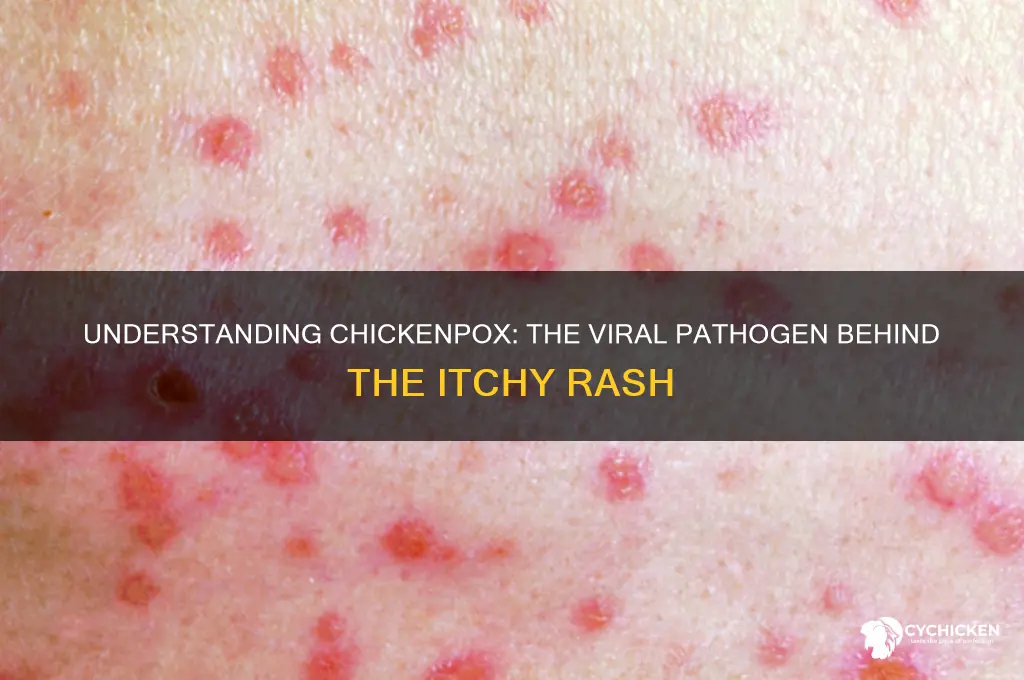 what type of pathogen is chicken box