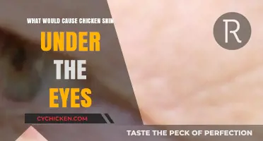 Under-Eye Chicken Skin: Causes and Solutions for Smooth Skin