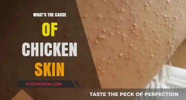 Understanding Keratosis Pilaris: The Common Cause of Chicken Skin