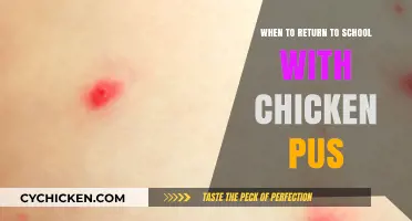 Returning to School with Chickenpox: Timing and Safety Tips