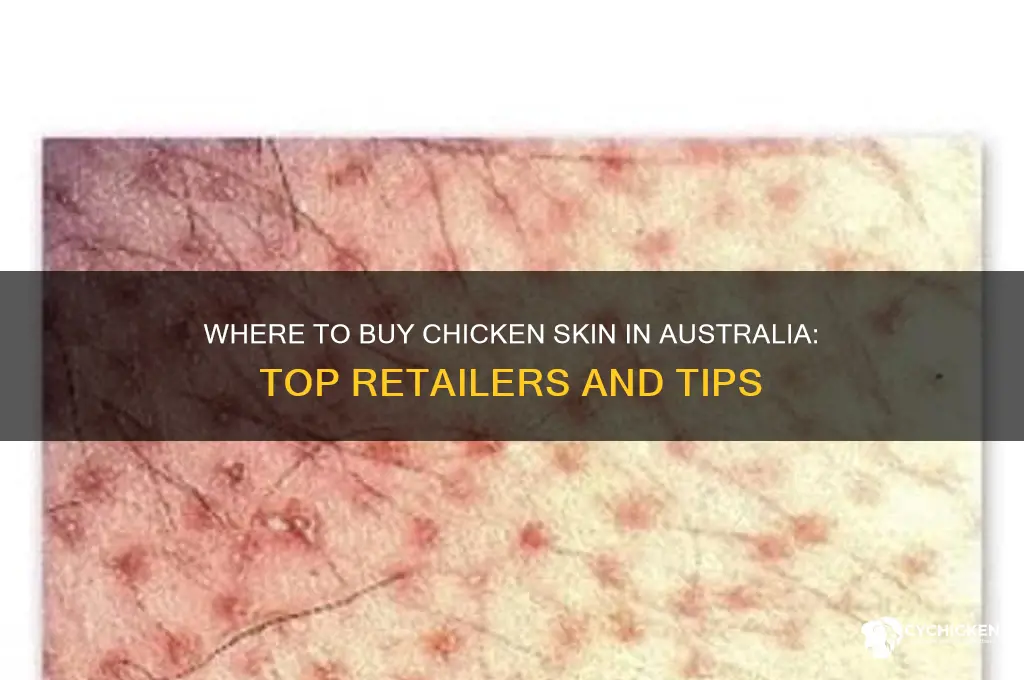 where to buy chicken skin australia