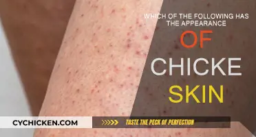 What Skin Conditions Look Like Chicken Skin?