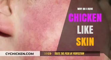 Understanding Keratosis Pilaris: Causes and Solutions for Chicken-Like Skin