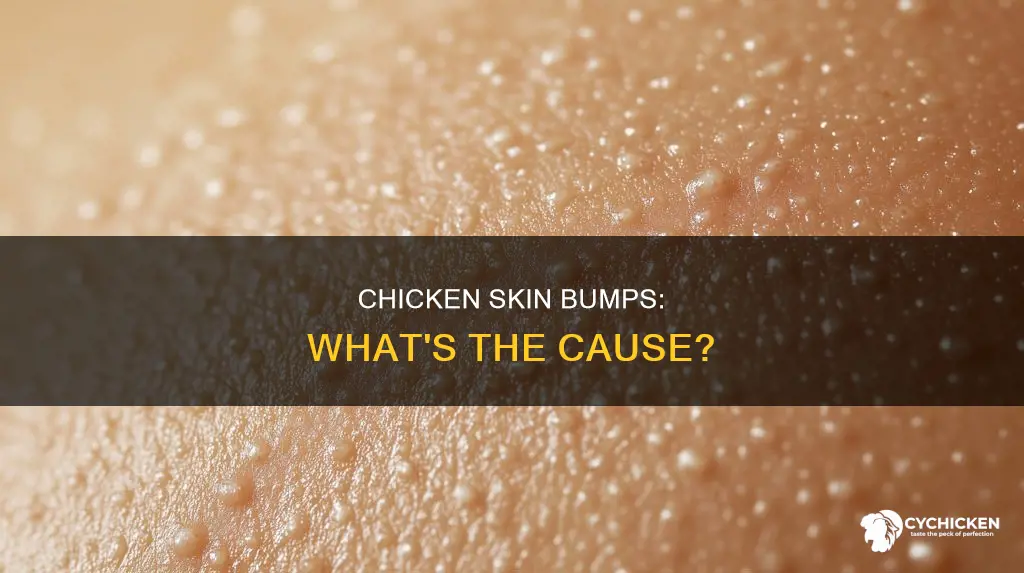 why do i have chicken skin all over my body