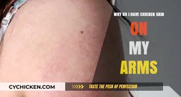 Understanding Keratosis Pilaris: Chicken Skin on Arms