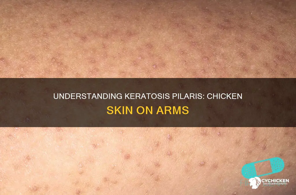 why do i have chicken skin on my arms