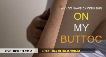 Understanding Keratosis Pilaris and Its Impact on Your Skin