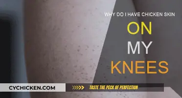 Chicken Skin on Knees: What's the Cause?