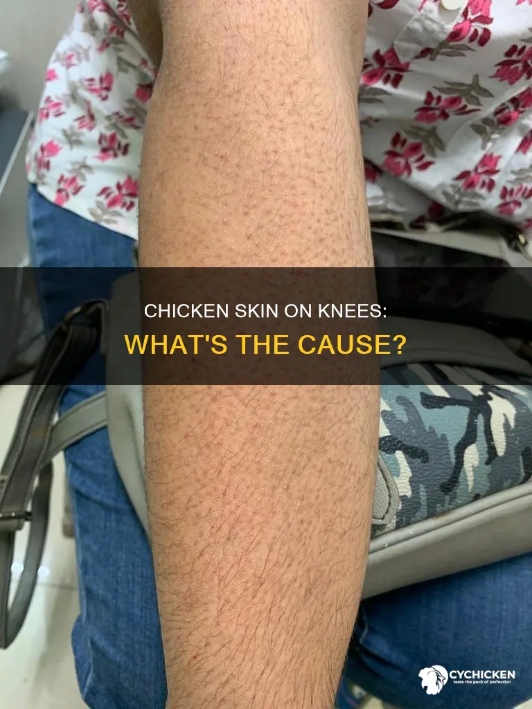 why do i have chicken skin on my knees