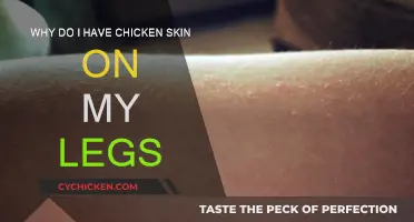 How to Get Rid of Chicken Skin on Legs?