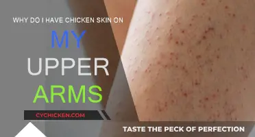 Understanding Keratosis Pilaris and How to Treat It