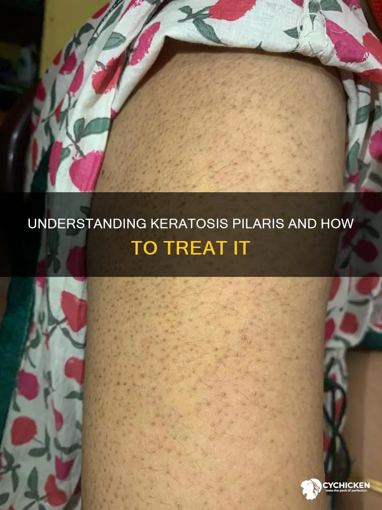 why do i have chicken skin on my upper arms