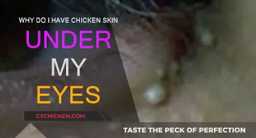 How to Get Rid of Chicken Skin Under Eyes?