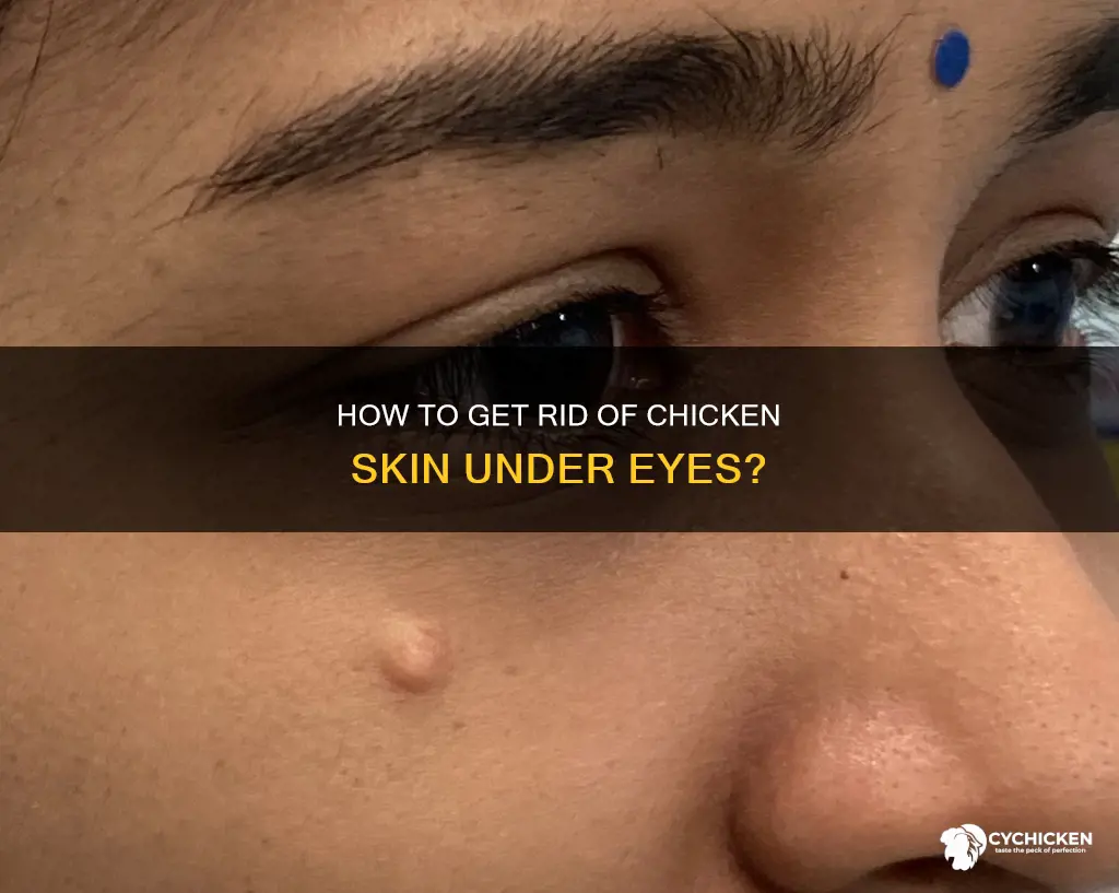 why do i have chicken skin under my eyes