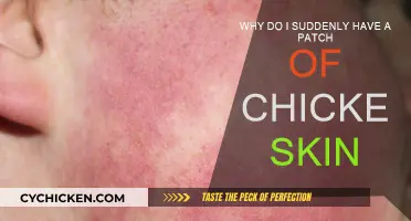 What's This Chicken Skin Patch?