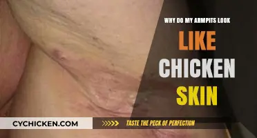 Understanding Armpit Keratosis Pilaris: Causes and Solutions for Chicken Skin