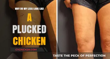 Why Do My Legs Look Like a Plucked Chicken? Understanding Skinny Fat