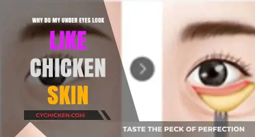 Why Do My Under Eyes Look Like Chicken Skin?