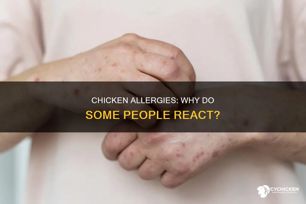 why does chicken cause anaflactic reaction but not always