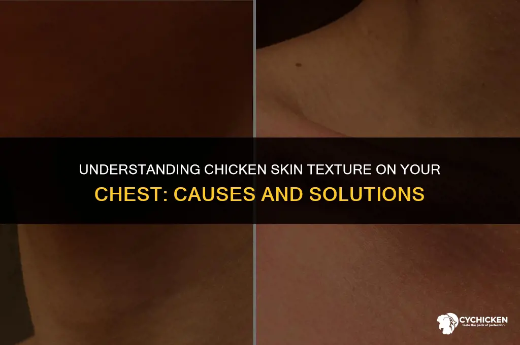 why does my chest look like chicken skin