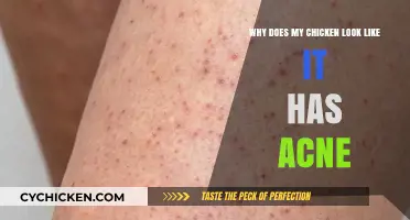 Cluck and Clear: Understanding Chicken Skin Bumps and Acne