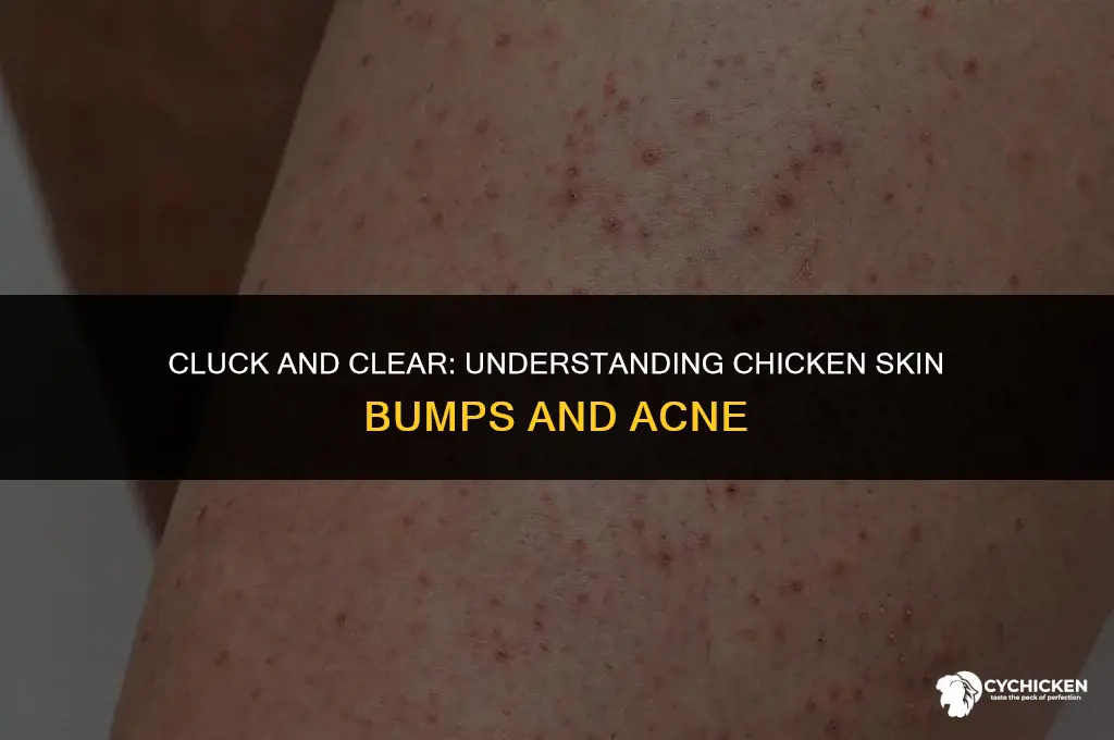 why does my chicken look like it has acne
