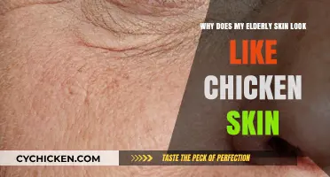 Understanding Chicken Skin Texture in Elderly: Causes and Solutions