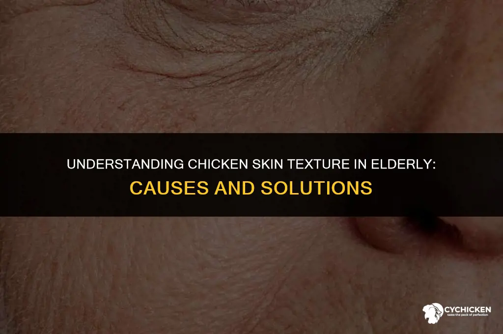 why does my elderly skin look like chicken skin