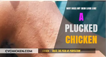 Unveiling the Mystery: Why Your Skin Resembles a Plucked Chicken