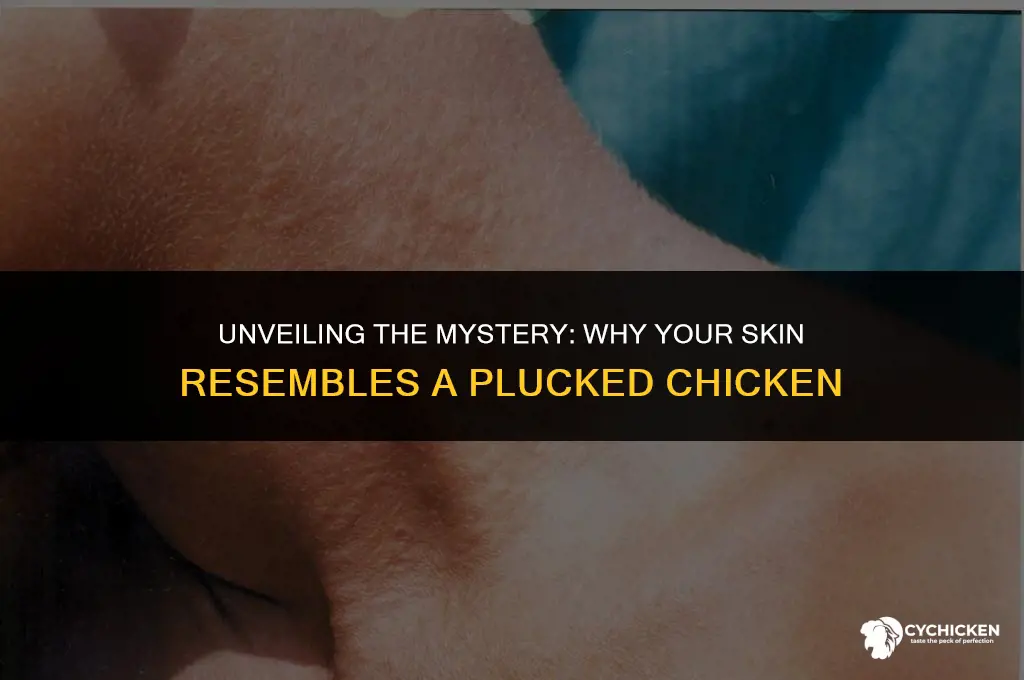 why does my skin look like a plucked chicken